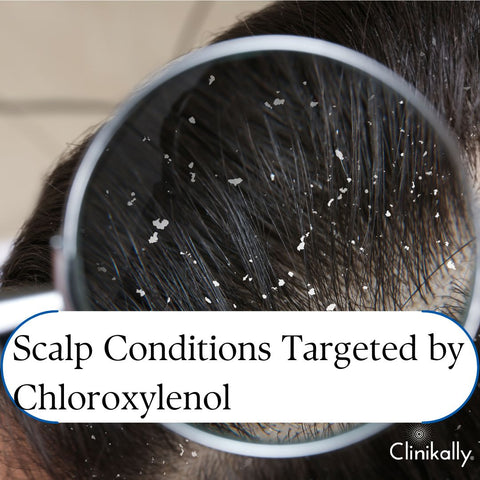 Scalp Conditions Targeted by Chloroxylenol