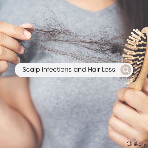 Scalp Infections and Hair Loss