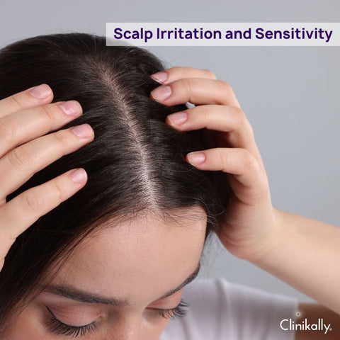 Scalp Irritation and Sensitivity