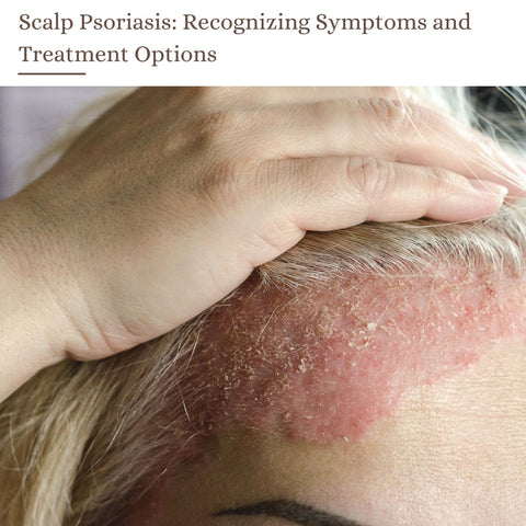 Scalp Psoriasis: Recognizing Symptoms and Treatment Options