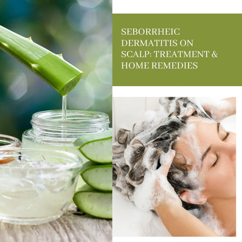 Seborrheic Dermatitis on Scalp: Treatment & Home Remedies