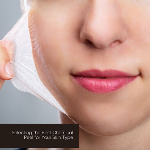 Selecting the Best Chemical Peel for Your Skin Type
