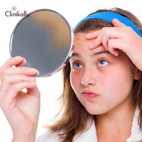 Side Effects of Rosehip Oil on Skin and How to Avoid Them
