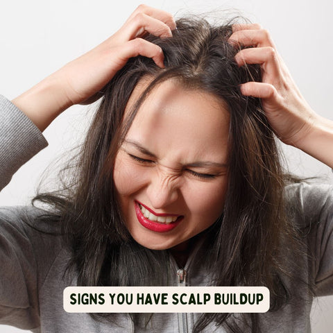 Signs You Have Scalp Buildup