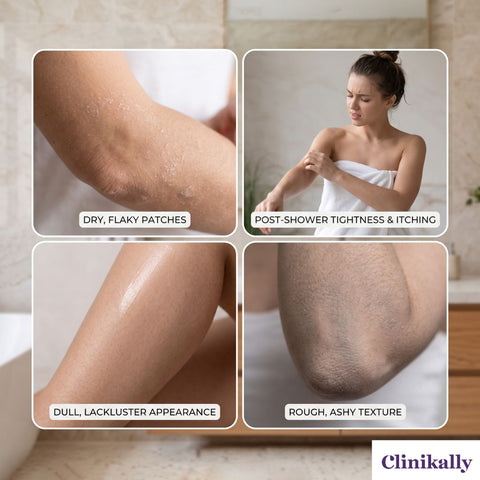 Common signs of dry skin needing a hydrating body wash