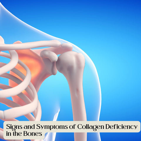 Signs and Symptoms of Collagen Deficiency in the Bones
