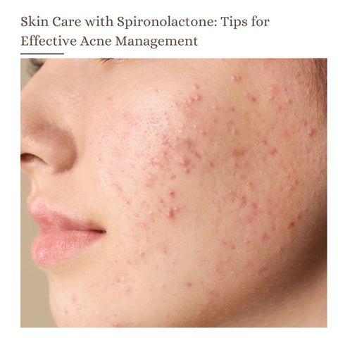 Skin Care with Spironolactone: Tips for Effective Acne Management