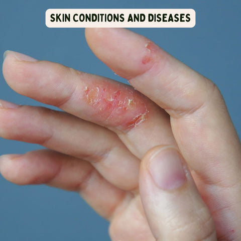 Skin Conditions and Diseases