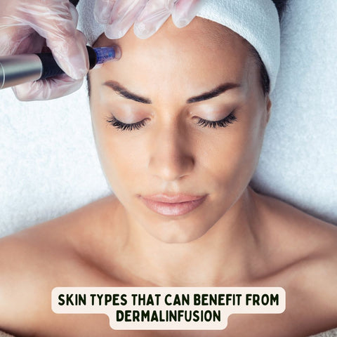 Skin Types That Can Benefit from Dermalinfusion