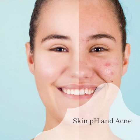 Skin pH and Acne
