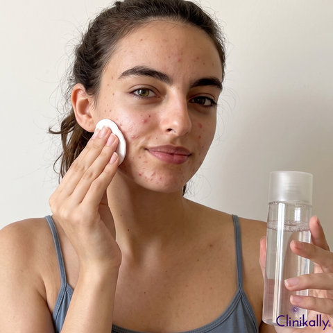Skincare routine for managing PMOS related acne