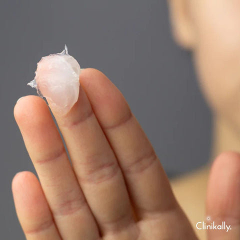 Slugging for acne-prone skin: Pros and cons
