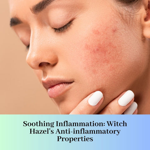 Soothing Inflammation: Witch Hazel's Anti-inflammatory Properties
