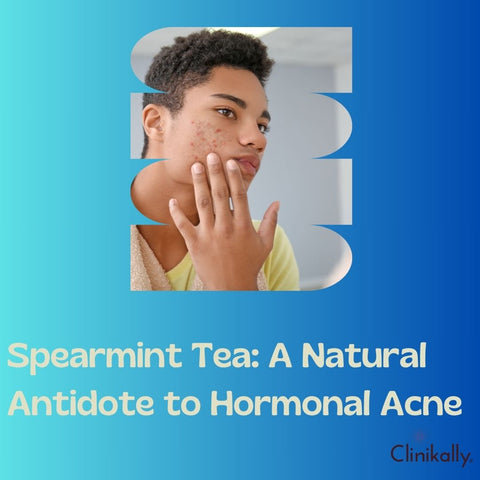 Spearmint Tea: A Natural Antidote to Hormonal Acne