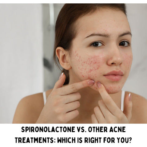 Spironolactone vs. Other Acne Treatments: Which Is Right for You?
