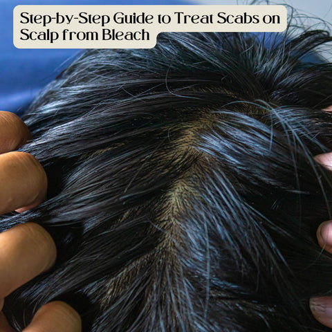 Step-by-Step Guide to Treat Scabs on Scalp from Bleach