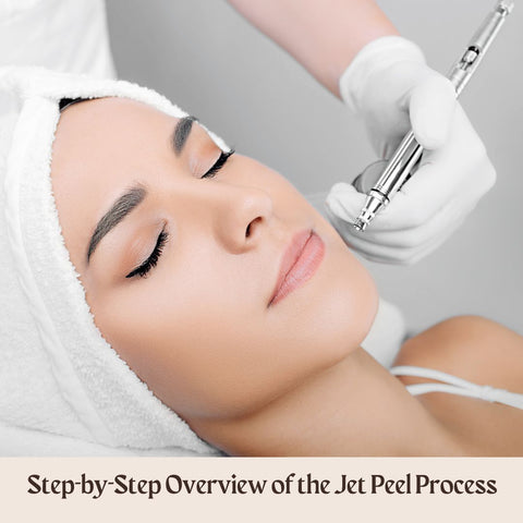 Step-by-Step Overview of the Jet Peel Process