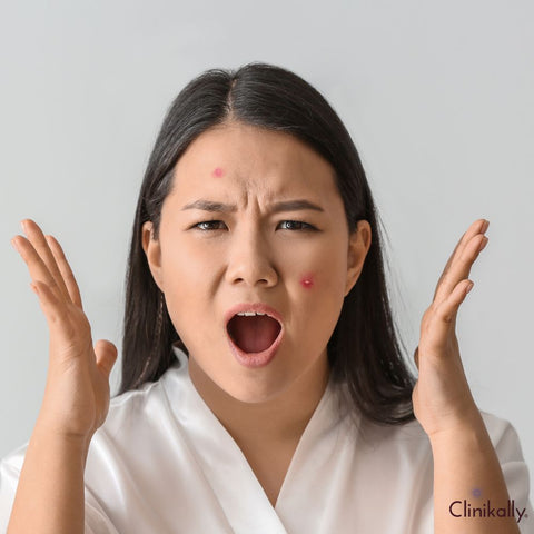 Stress and its effects on skin condition