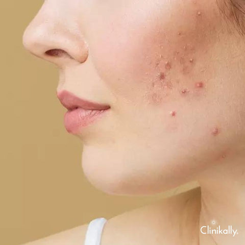 Understanding Sulfur Side Effects