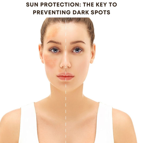 Sun Protection: The Key to Preventing Dark Spots