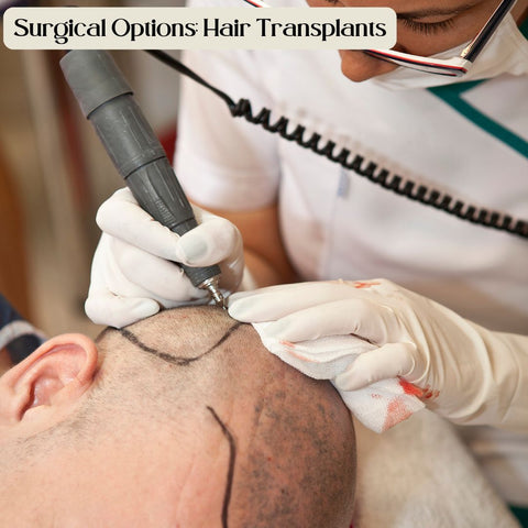 Surgical Options: Hair Transplants