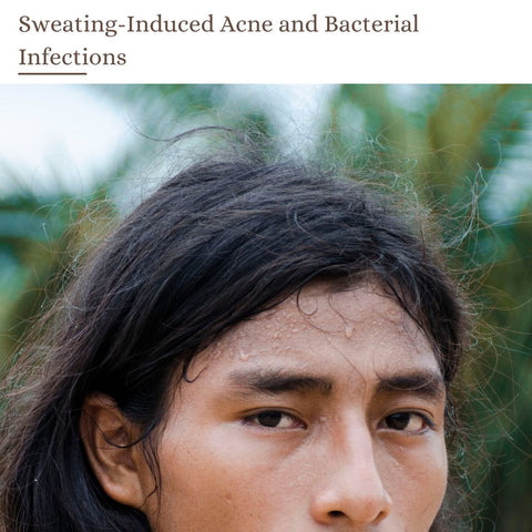 Sweating-Induced Acne and Bacterial Infections