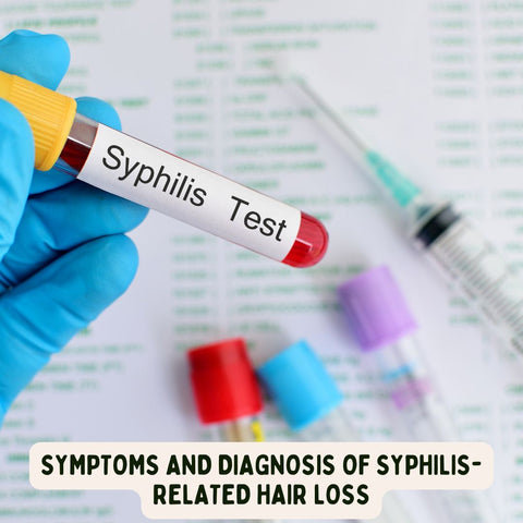 Symptoms and Diagnosis of Syphilis-Related Hair Loss
