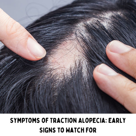 Symptoms of Traction Alopecia: Early Signs to Watch For