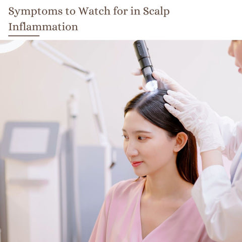 A women getting laser treatment from a dermatologist "Symptoms to Watch for in Scalp Inflammation"