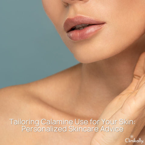 Tailoring Calamine Use for Your Skin: Personalized Skincare Advice
