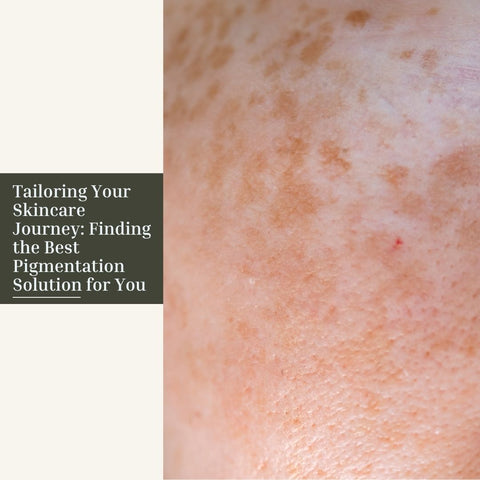 Tailoring Your Skincare Journey: Finding the Best Pigmentation Solution for You