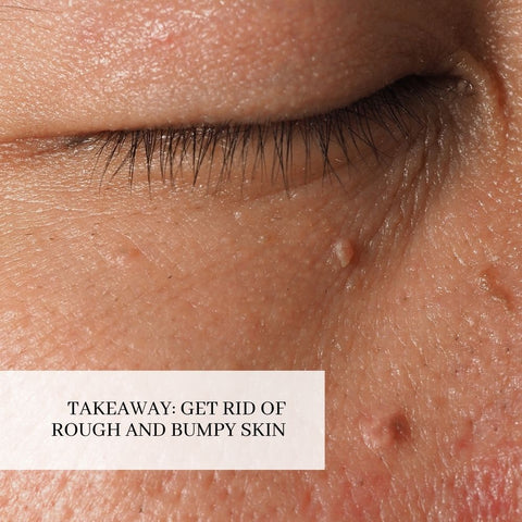 Takeaway: Get Rid of Rough and Bumpy Skin