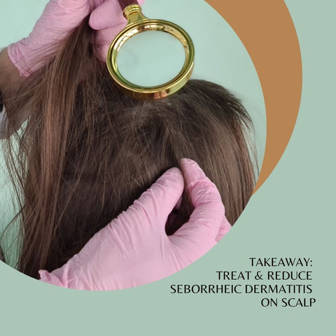 Takeaway: Treat & Reduce Seborrheic Dermatitis on Scalp