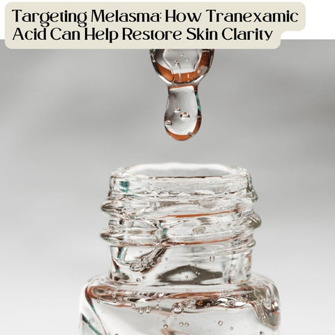 Targeting Melasma: How Tranexamic Acid Can Help Restore Skin Clarity