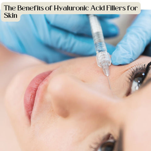 The Benefits of Hyaluronic Acid Fillers for Skin