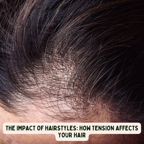 The Impact of Hairstyles: How Tension Affects Your Hair