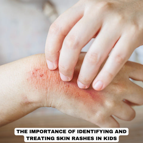 Factors Contributing to Skin Rashes in Children