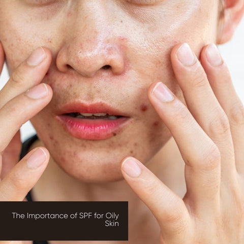 The Importance of SPF for Oily Skin