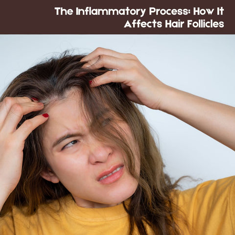 An angry women scratching her scalp with both the hands. The text on the image is "The Inflammatory Process: How It Affects Hair Follicles"