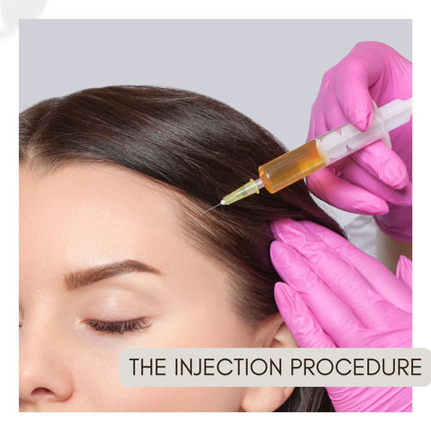 The Injection Procedure