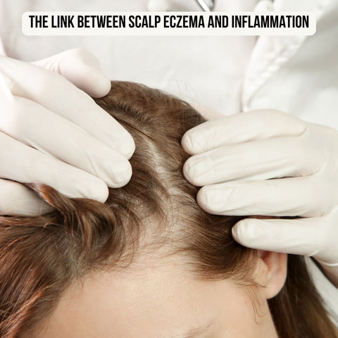 The Link Between Scalp Eczema and Inflammation