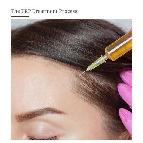 The PRP Treatment Process