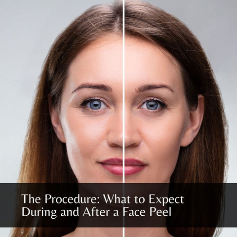 The Procedure: What to Expect During and After a Face Peel