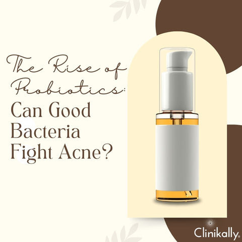 The Rise of Probiotics: Can Good Bacteria Fight Acne?