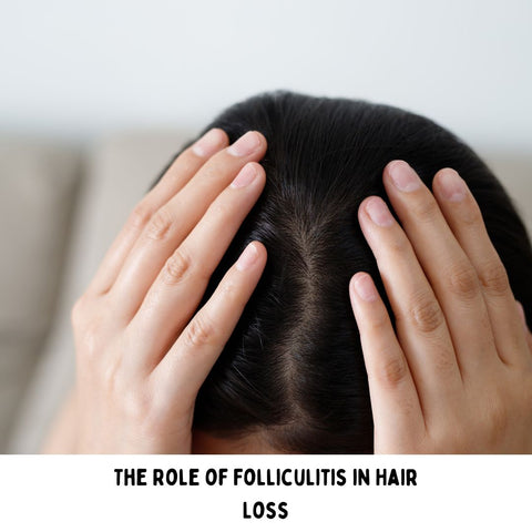 A women with her hands on her head. The image text is "The Role of Folliculitis in Hair Loss"