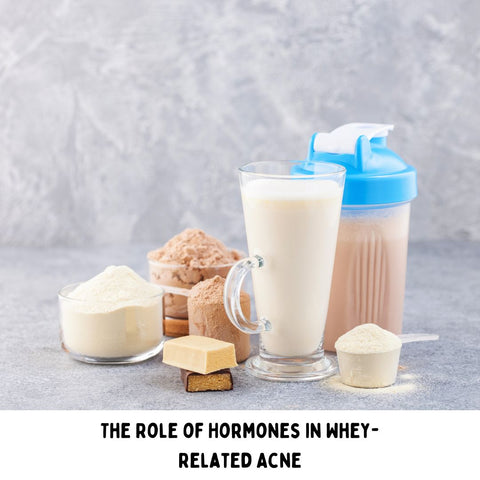The Role of Hormones in Whey-Related Acne