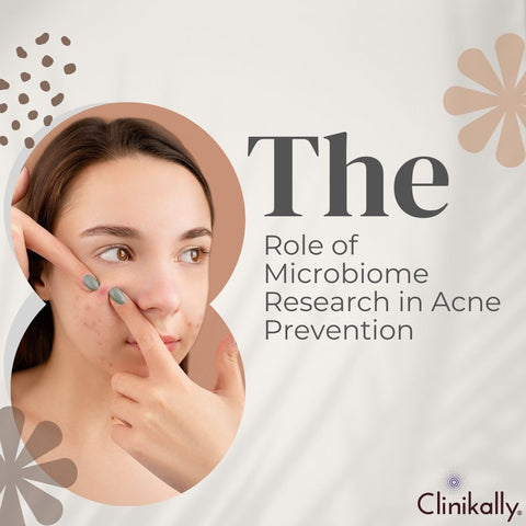 The Role of Microbiome Research in Acne Prevention