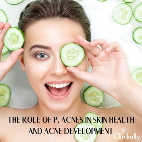 The Role of P. Acnes in Skin Health and Acne Development