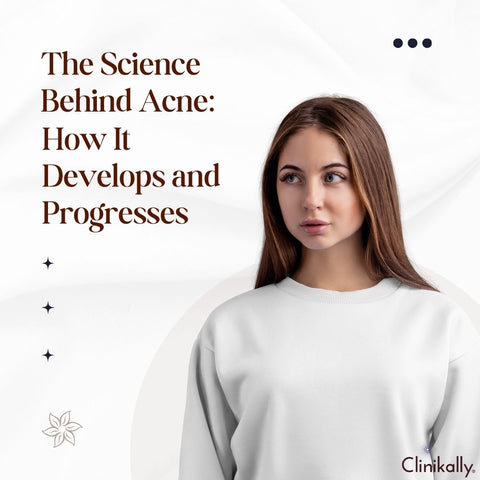 The Science Behind Acne: How It Develops and Progresses