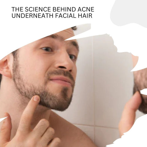 The Science Behind Acne Underneath Facial Hair